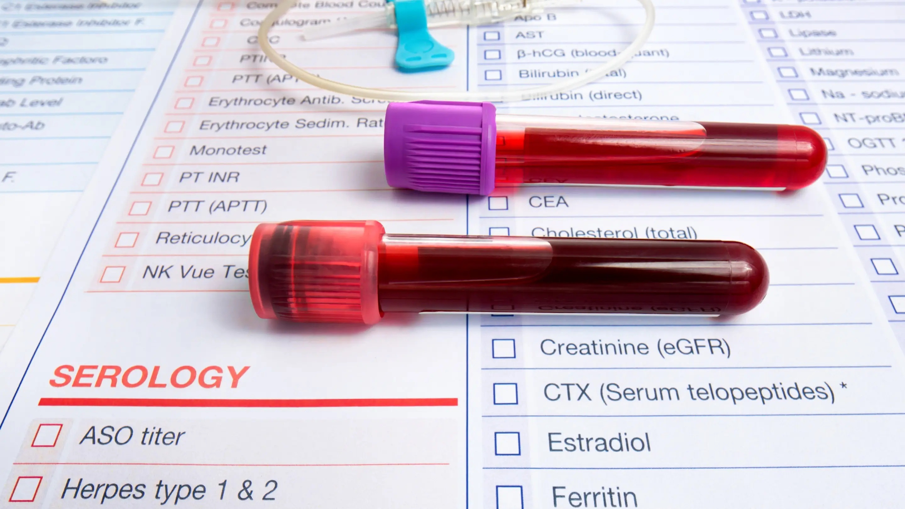 Serology Testing